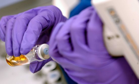 Lab samples