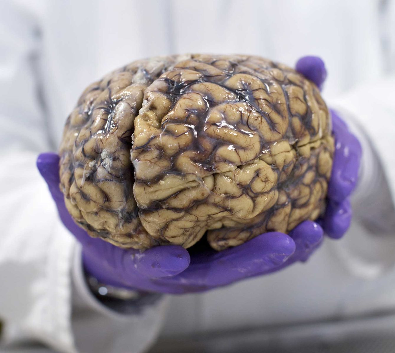 Brain