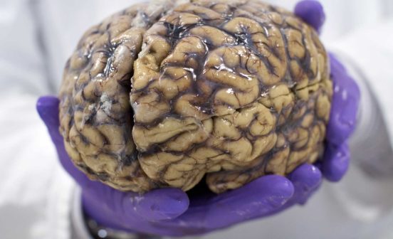 Brain