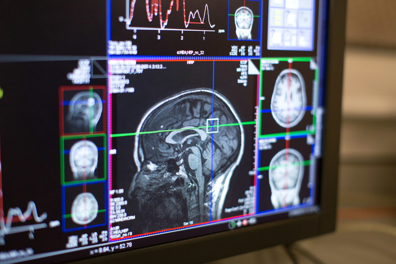 Kisspeptin: Exploring the hormone which can enhance brain activity associated with love and sex thumbnail