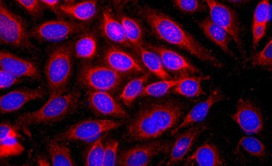 Guideline Research shows risk of dying of cancer differs greatly across regions in England
