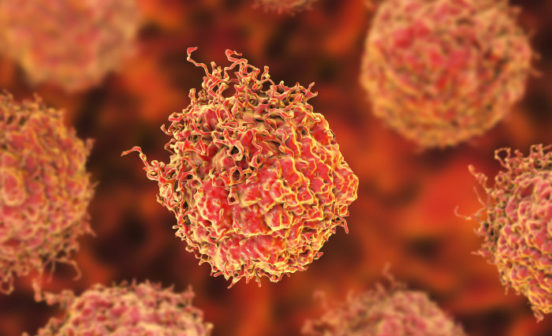 Accessible screening and better diagnosis for prostate cancer