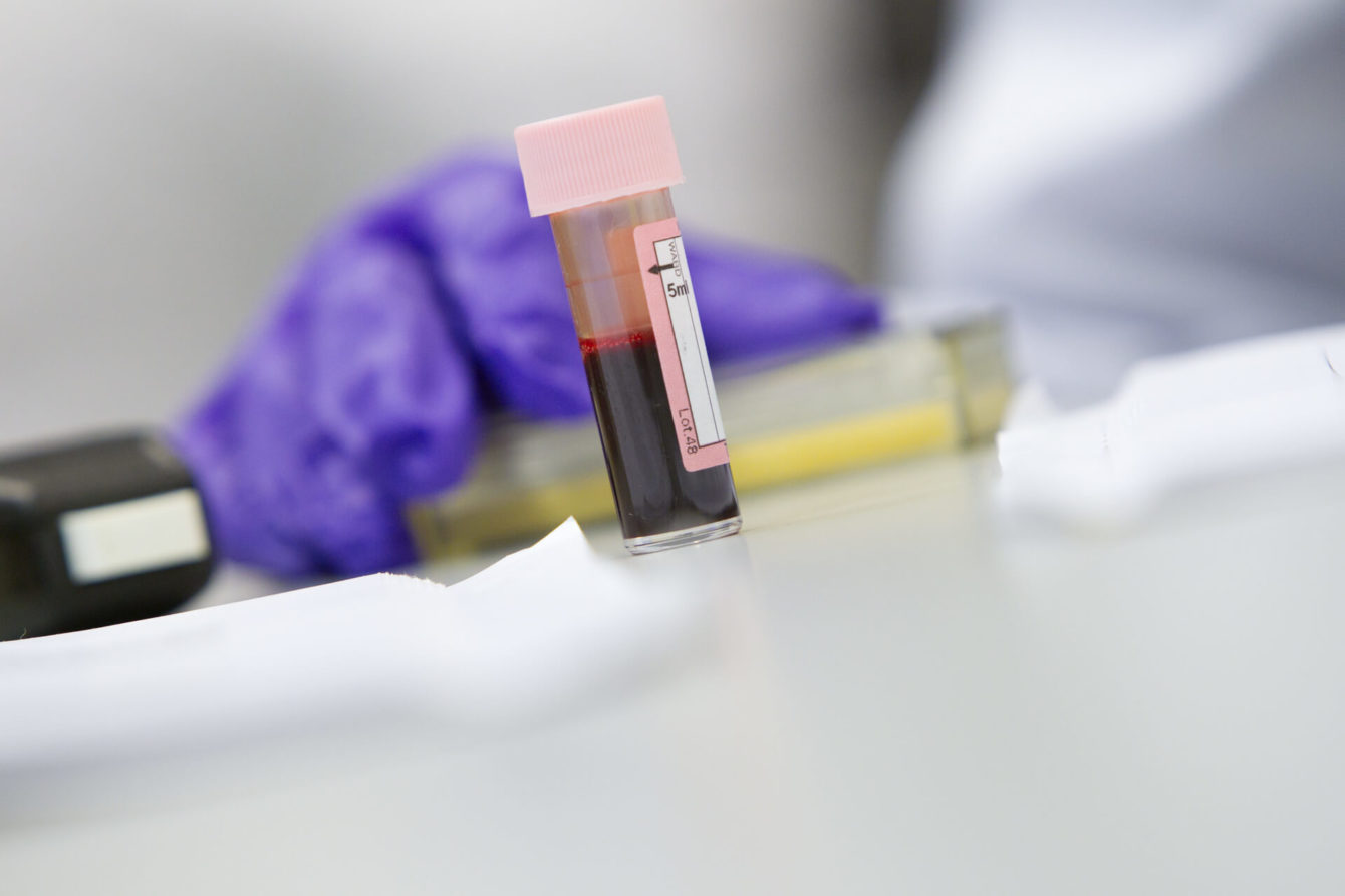 BLood_Tube_imperialo_tiny