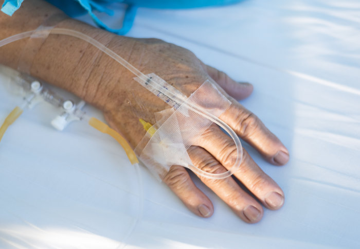 Immunotherapy