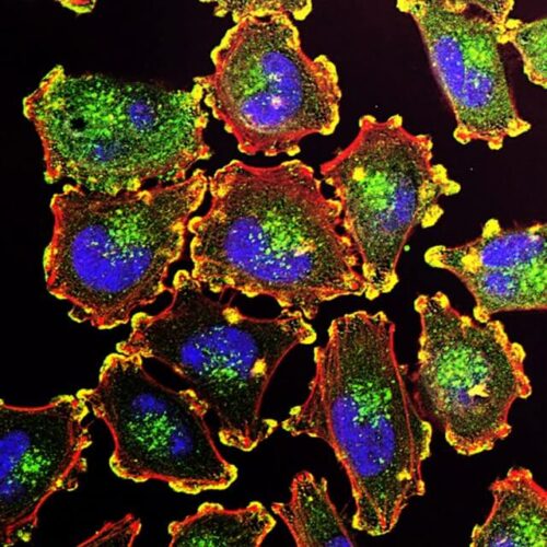 Options for treatment resistant cancers