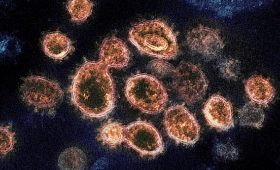National Institute of Allergy and Infectious Diseases (US)