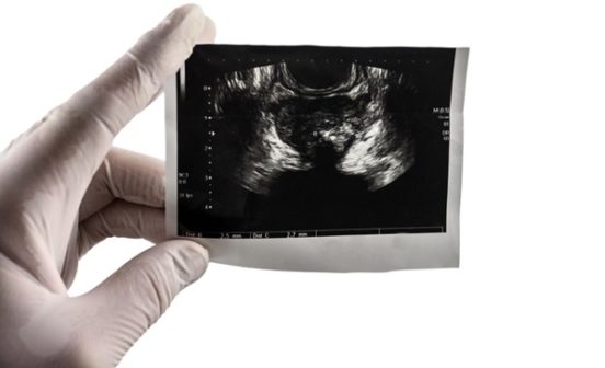 Prostate MRI image