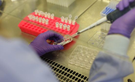 scientist using a pipette is testing samples in a laboratory environment