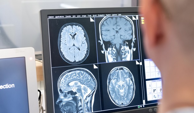 MRI Brain Scan