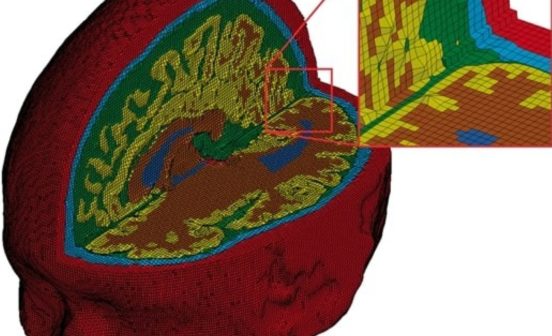 Image of the 3D modelling system used to examine the brain after injury.
