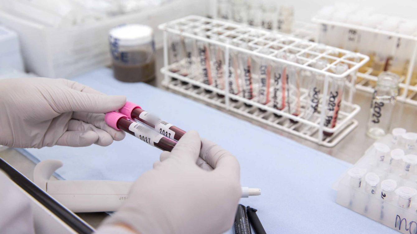 scientist examines blood samples
