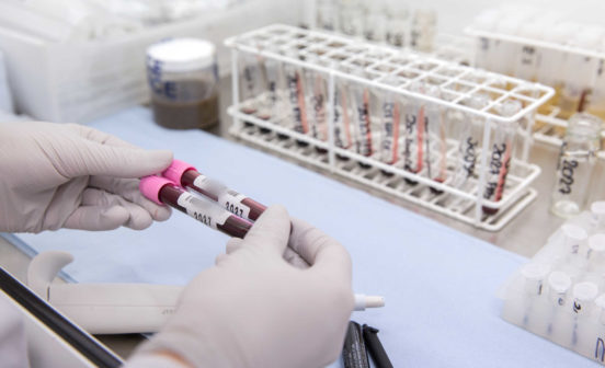 scientist examines blood samples
