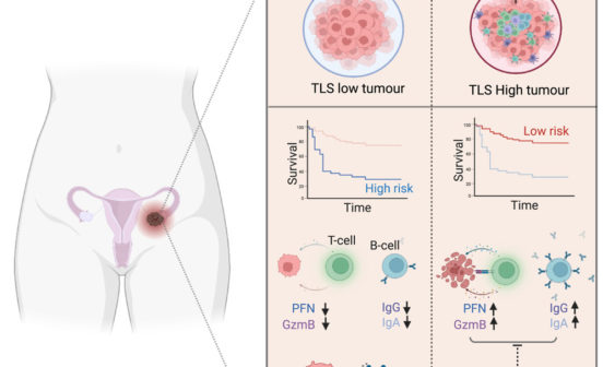 Diagnostic Ovarian cancer study identifies key genes for potential treatments