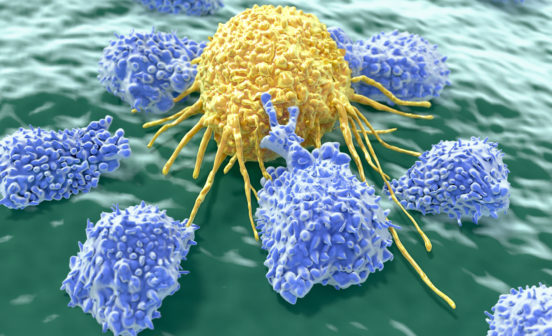 Award Imperial start-up raises additional investment for cell therapy targeting ovarian cancer