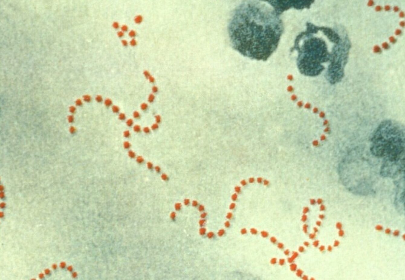 Strep A