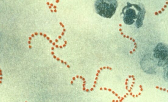 Strep A